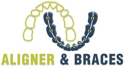 aligner-and-braces-png-1-2-1 (2).png